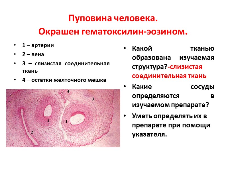 Пуповина человека.  Окрашен гематоксилин-эозином. 1 – артерии 2 – вена 3 – слизистая